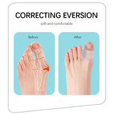 Bunion Corrector & Toe Separator - Hallux Valgus Toe Straightener for Ingrown Toenail Corrector and Foot Pain Relief